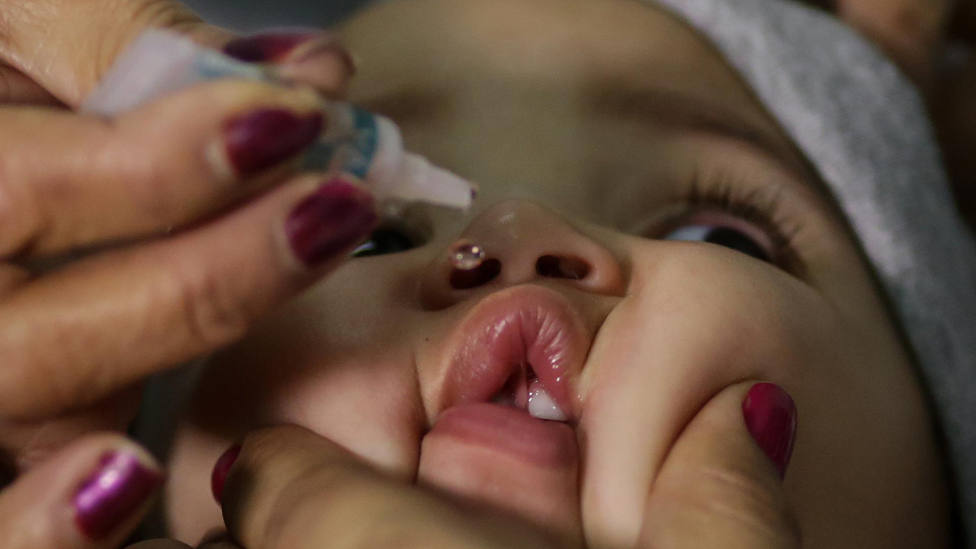 Preocupación por el resurgir de la polio: ¿cómo nos afecta a España?