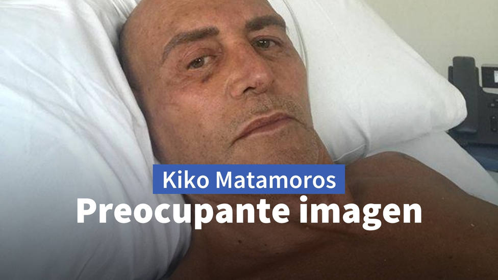 La preocupante imagen de Kiko Matamoros en el hospital que hace saltar todas las alarmas