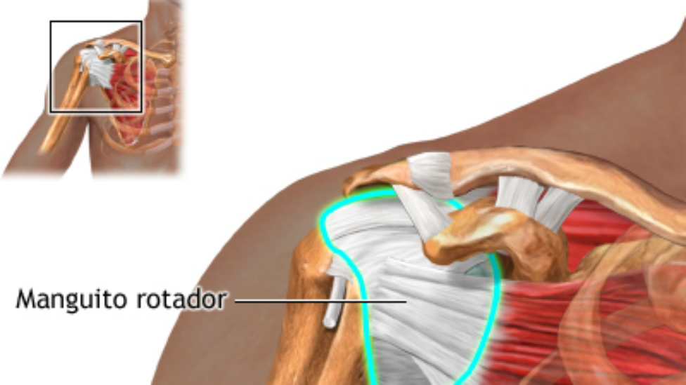 Conoce Todo Lo Que Debes Saber Sobre Las Lesiones Del Manguito De Los Rotadores De Hombro