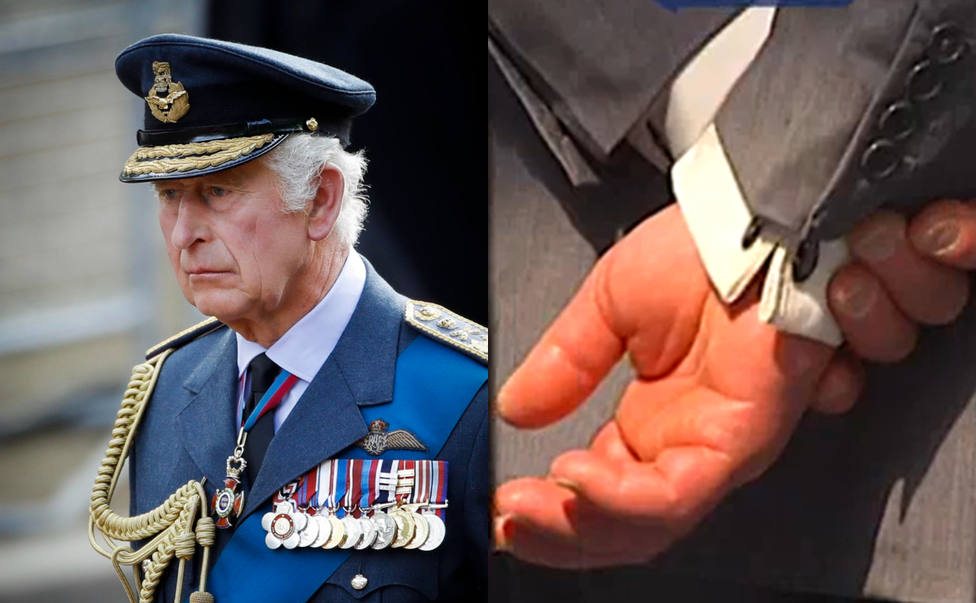 Un experto explica por qué el Rey Carlos III tiene las manos y los dedos hinchados: Afecta también a la piel