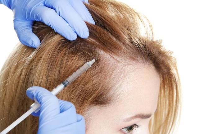 Sentimiento de culpa Bloquear grueso Alopecia en mujeres: Estos son los mejores tratamientos para evitarla -  Vivir - COPE