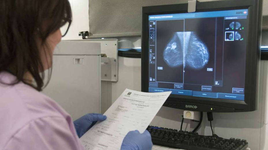Una inmunoterapia cura a una mujer con cáncer de mama metastásico