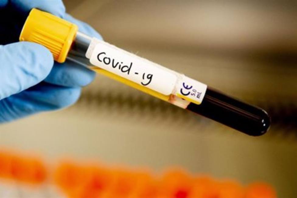 Aragón confirma 8 fallecidos por coronavirus en las últimas 24 horas