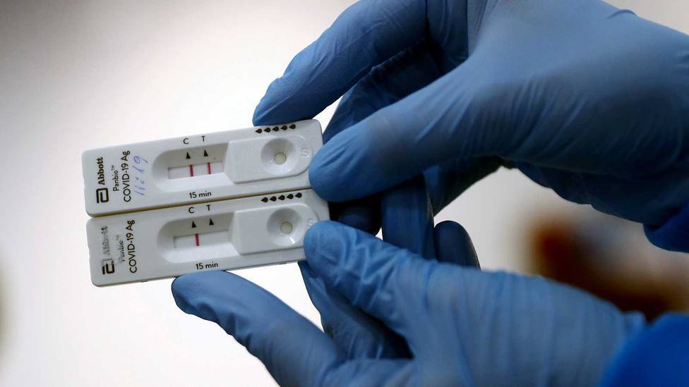 Brasil desarrolla un test de orina para detectar anticuerpos contra el SARS-CoV-2
