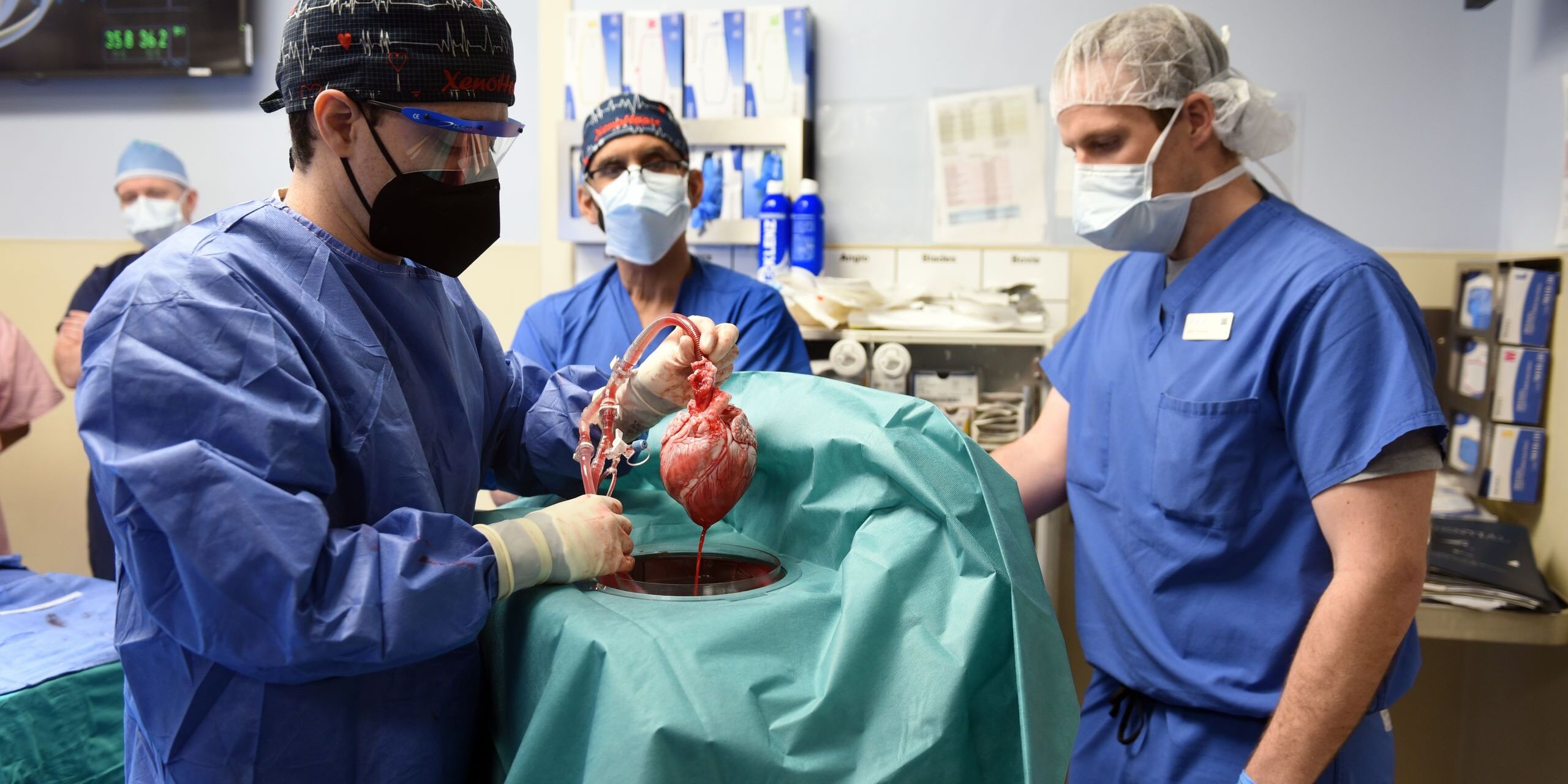 Qué dilemas éticos hay detrás de los trasplantes con órganos de animales? -  Mediodía COPE - COPE